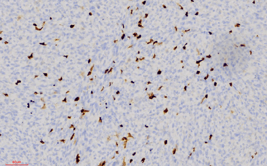 Pulsos electromagnéticos contra el cáncer: una investigación española abre la puerta a tratamientos sin fármacos ni cirugía