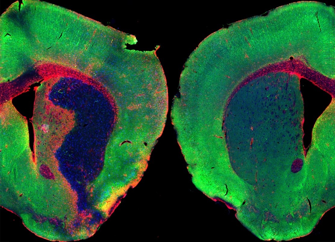 Un estudio del CSIC identifica una molécula con potencial para reducir el daño cerebral tras un ictus