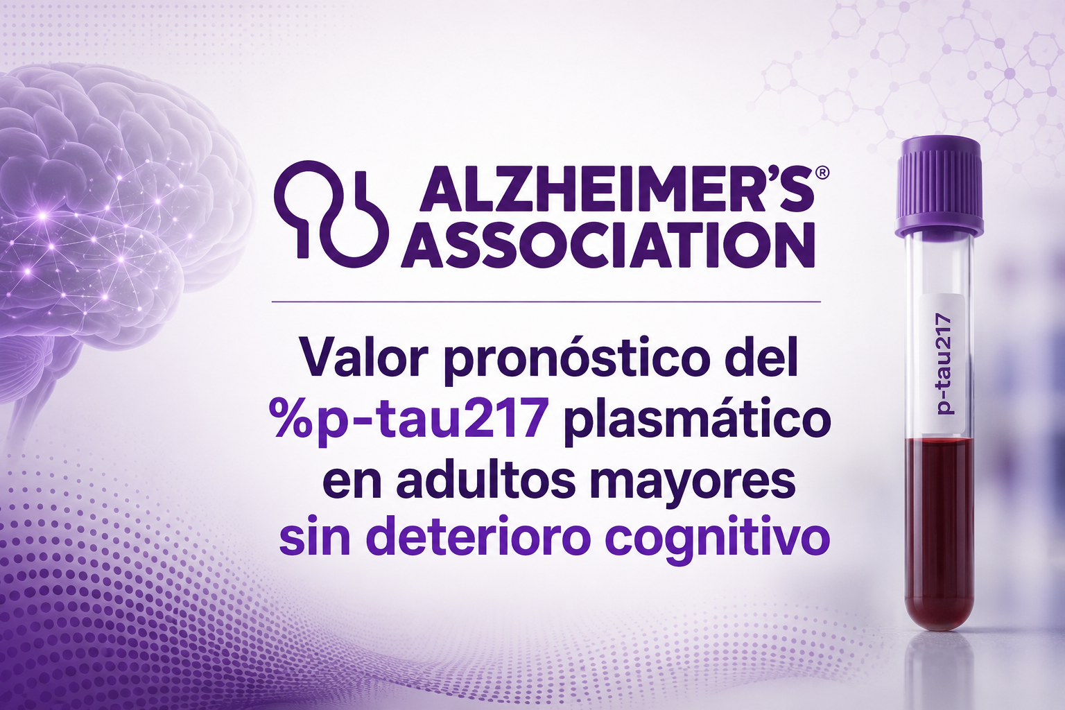 Un análisis de sangre permite estimar el riesgo de alzhéimer hasta diez años antes de los primeros síntomas