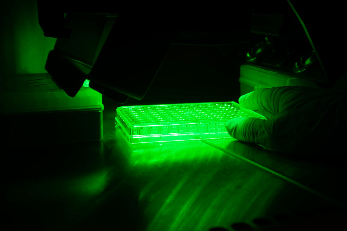 Materiales antimicrobianos: la investigación del CSIC que busca prevenir las infecciones
